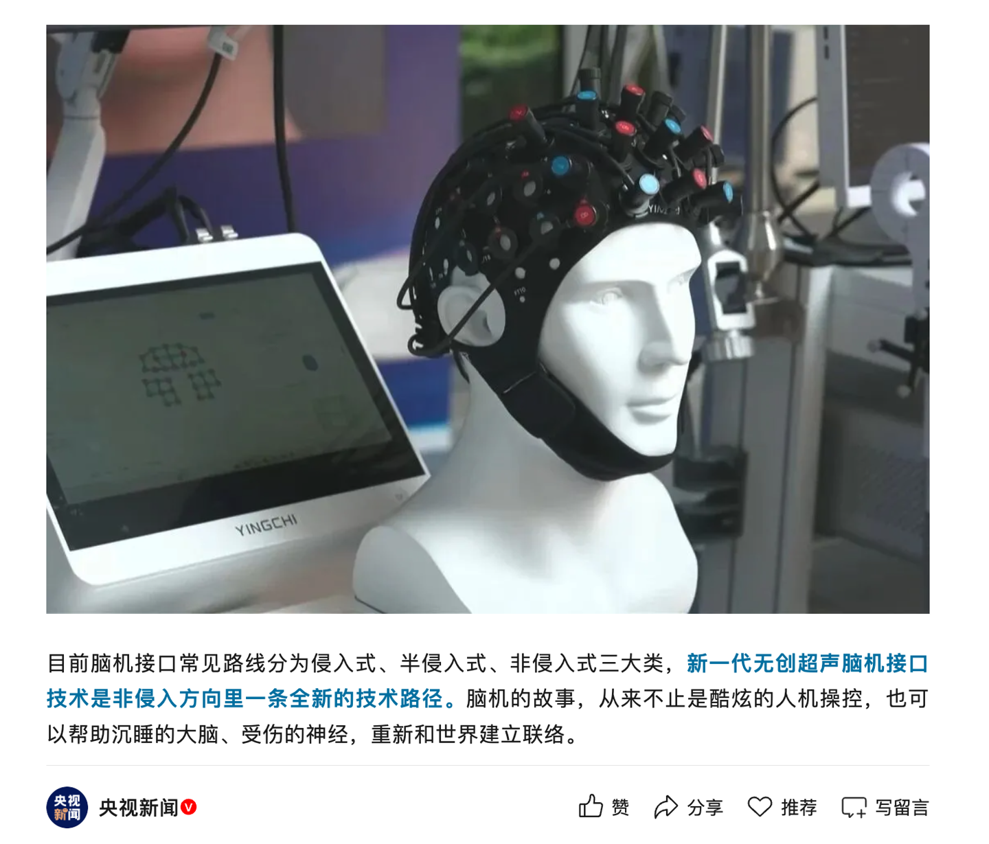 新一代无创超声脑机接口亮相：无需开颅，持续 4 周干预有望唤醒“植物人”